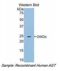 人血管紧张素原(AGT)多克隆抗体