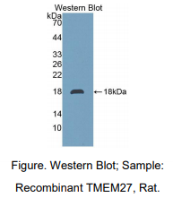 https://msimg.bioon.com/bionline/goods-no-pic.png