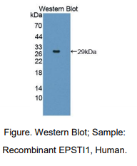 人上皮基质相互作用蛋白1(EPSTI1)多克隆抗体