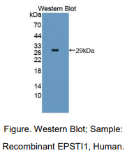 https://msimg.bioon.com/bionline/goods-no-pic.png