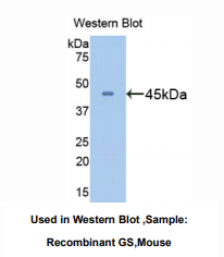 https://msimg.bioon.com/bionline/goods-no-pic.png