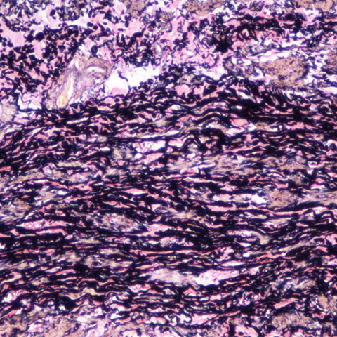 https://msimg.bioon.com/bionline/goods-no-pic.png
