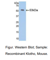 https://msimg.bioon.com/bionline/goods-no-pic.png