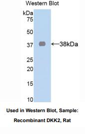 大鼠乳酸脱氢酶A(LDHA)多克隆抗体