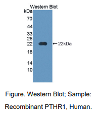 https://msimg.bioon.com/bionline/goods-no-pic.png