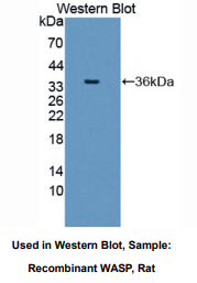 大鼠免疫缺陷伴血小板减少综合征蛋白(WASP)多克隆抗体