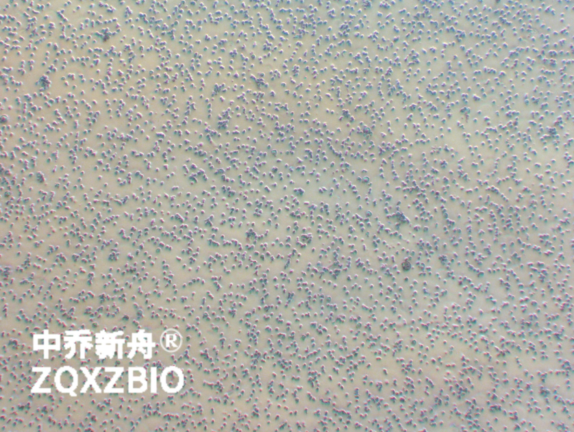 人B淋巴细胞急性白血病细胞