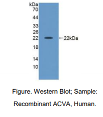 https://msimg.bioon.com/bionline/goods-no-pic.png