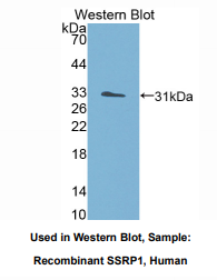 人结构特异性识别蛋白1(SSRP1)多克隆抗体