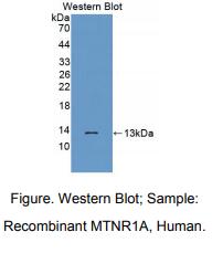 https://msimg.bioon.com/bionline/goods-no-pic.png