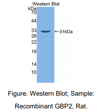 https://msimg.bioon.com/bionline/goods-no-pic.png