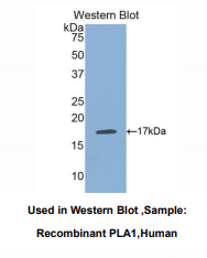 https://msimg.bioon.com/bionline/goods-no-pic.png