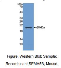 小鼠信号素5B(SEMA5B)多克隆抗体