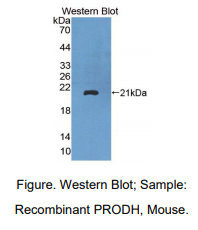 https://msimg.bioon.com/bionline/goods-no-pic.png