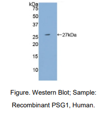 人妊娠特异性β1-糖蛋白(PSG1)多克隆抗体