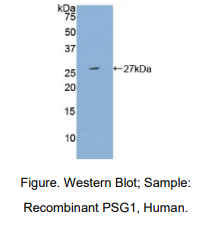 https://msimg.bioon.com/bionline/goods-no-pic.png