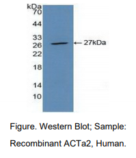 https://msimg.bioon.com/bionline/goods-no-pic.png