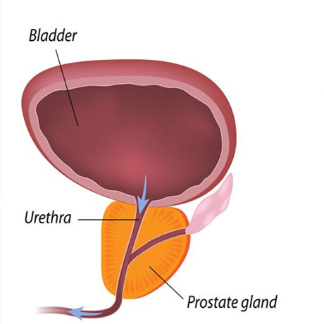 膀胱出口梗阻模型