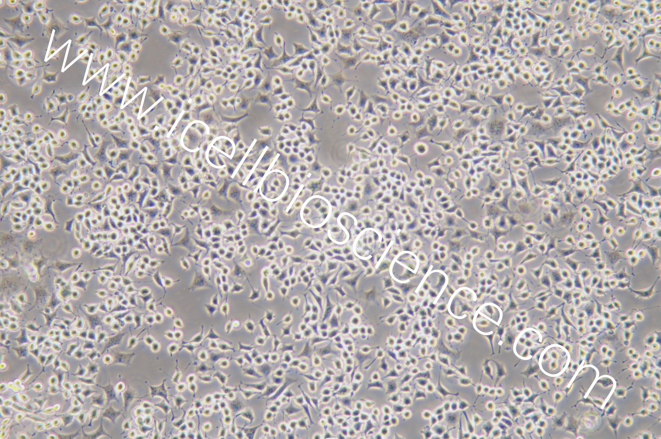 RLE-6TN细胞/RLE6TN细胞/RLE-6TN/RLE6TN/大鼠Ⅱ型肺泡上皮细胞