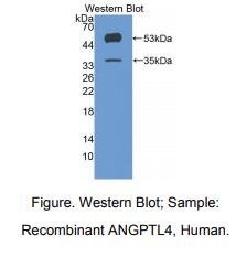 https://msimg.bioon.com/bionline/goods-no-pic.png