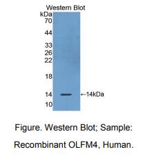 https://msimg.bioon.com/bionline/goods-no-pic.png