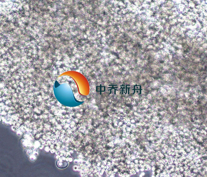 人胃癌细胞