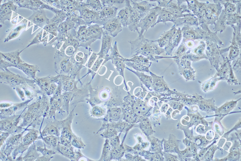 KHM-5M细胞/KHM5M细胞/KHM-5M/KHM5M/人甲状腺癌细胞（未分化）