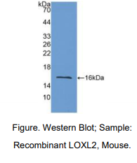 https://msimg.bioon.com/bionline/goods-no-pic.png