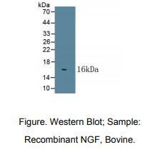 牛神经生长因子(NGF)多克隆抗体