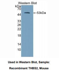 https://msimg.bioon.com/bionline/goods-no-pic.png