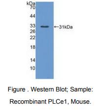 https://msimg.bioon.com/bionline/goods-no-pic.png