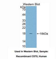 https://msimg.bioon.com/bionline/goods-no-pic.png