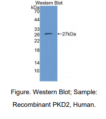 小鼠蛋白激酶D2(PKD2)多克隆抗体