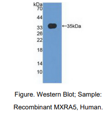 人基质重塑关联蛋白5(MXRA5)多克隆抗体