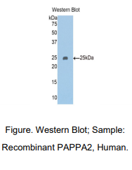 人妊娠相关血浆蛋白A2(PAPPA2)多克隆抗体