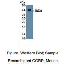 https://msimg.bioon.com/bionline/goods-no-pic.png