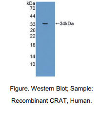 人肉毒碱乙酰转移酶(CRAT)多克隆抗体