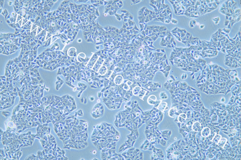 HCC1833细胞/HCC-1833细胞/HCC-1833/HCC1833/人肺癌腺癌细胞
