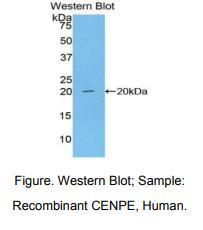 人着丝粒蛋白E(CENPE)多克隆抗体