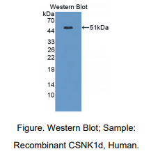 人酪蛋白激酶1δ(CSNK1d)多克隆抗体