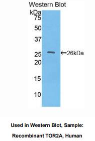 人耐扭蛋白2A(TOR2A)多克隆抗体