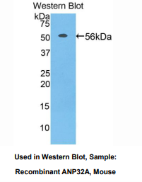 https://msimg.bioon.com/bionline/goods-no-pic.png