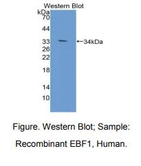 https://msimg.bioon.com/bionline/goods-no-pic.png