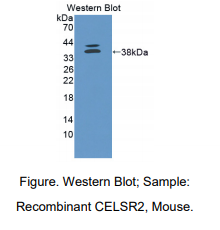 https://msimg.bioon.com/bionline/goods-no-pic.png