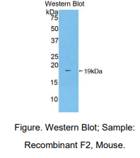 https://msimg.bioon.com/bionline/goods-no-pic.png