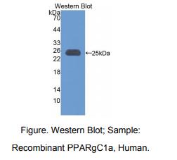人过氧化物酶体增殖物激活受体γ辅激活因子1α(PPARgC1a)多克隆抗体