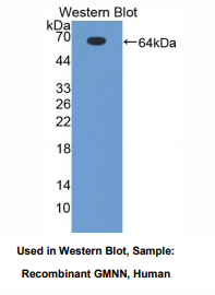 https://msimg.bioon.com/bionline/goods-no-pic.png