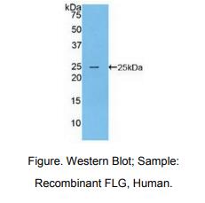 https://msimg.bioon.com/bionline/goods-no-pic.png