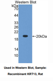 大鼠角蛋白13(CK13)多克隆抗体