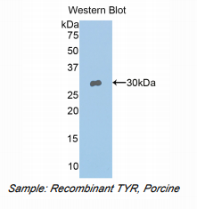 猪酪氨酸酶(TYR)多克隆抗体